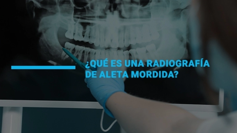 radiografia-aleta-mordida